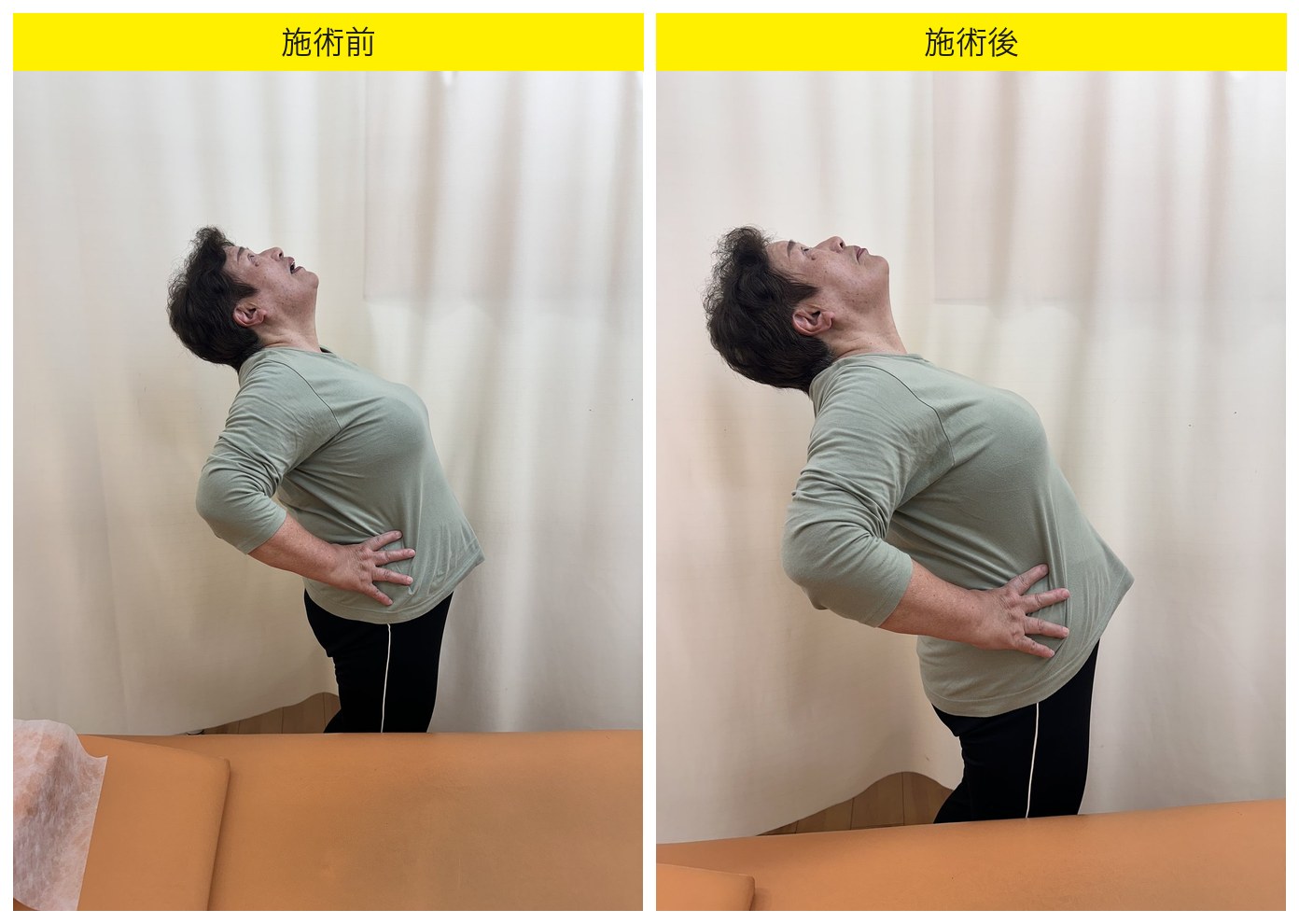 広島市中区舟入南の慢性腰痛 体幹可動性Before/After｜てあつい整体院 舟入院 K様