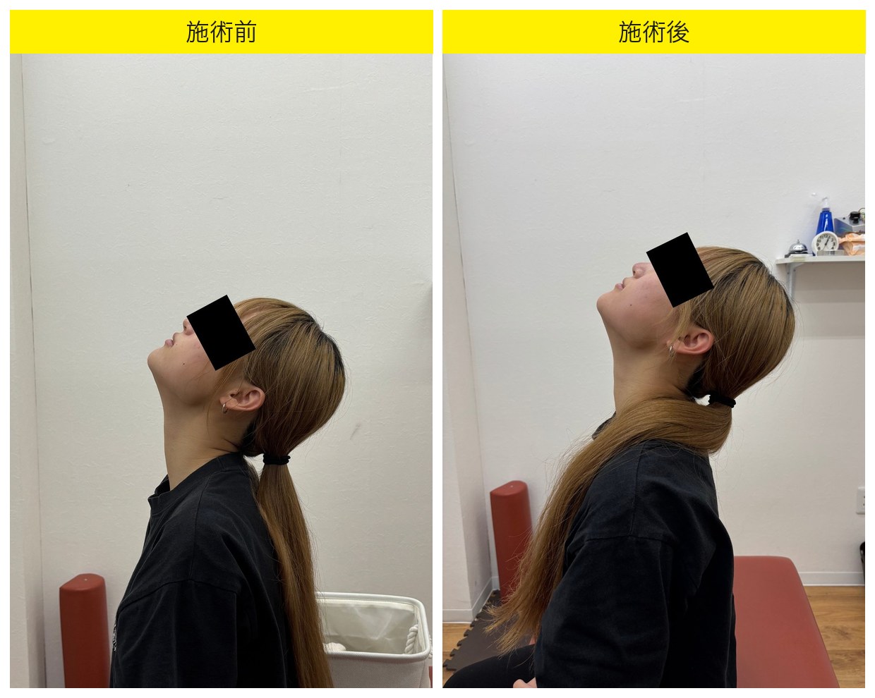下松市美里町の立ち仕事×複数症状 後屈動作Before/After(矢状面)|てあつい整体院 下松院 K様