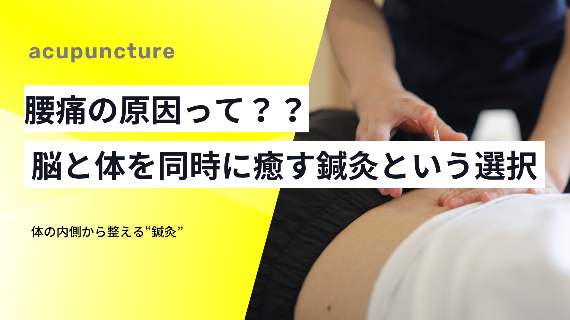 腰痛の原因って？？——脳と体を同時に癒す鍼灸という選択