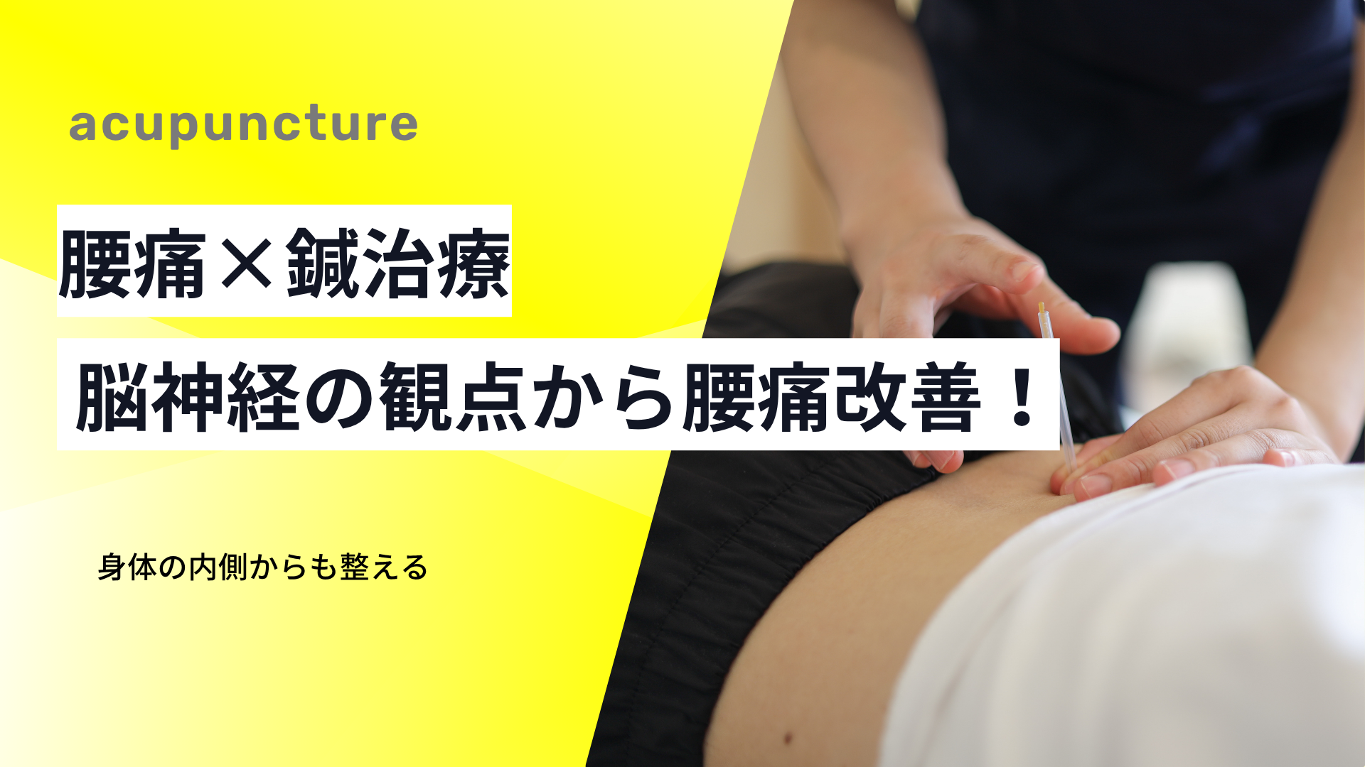 鍼治療と脳神経の観点から見る腰痛改善