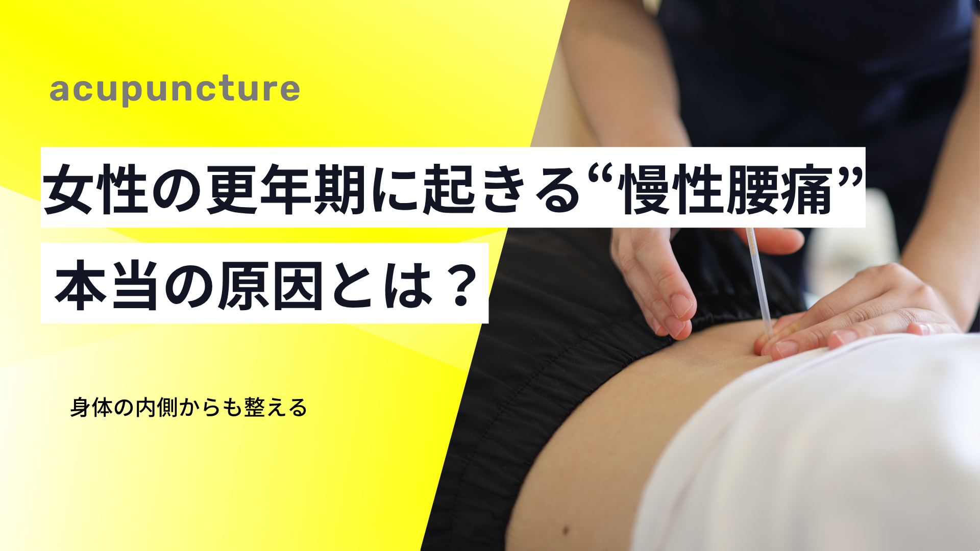 女性の更年期に起きる“慢性腰痛”の本当の原因とは？