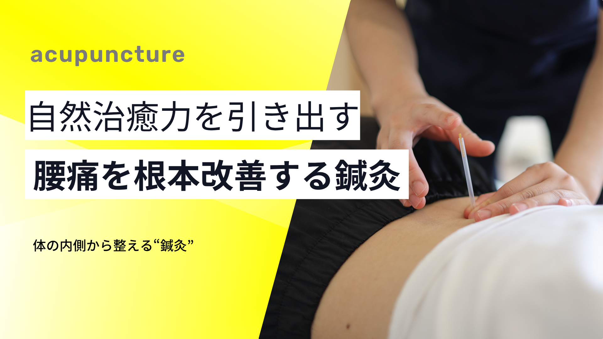 自然治癒力を引き出し、腰痛を根本から改善する鍼灸