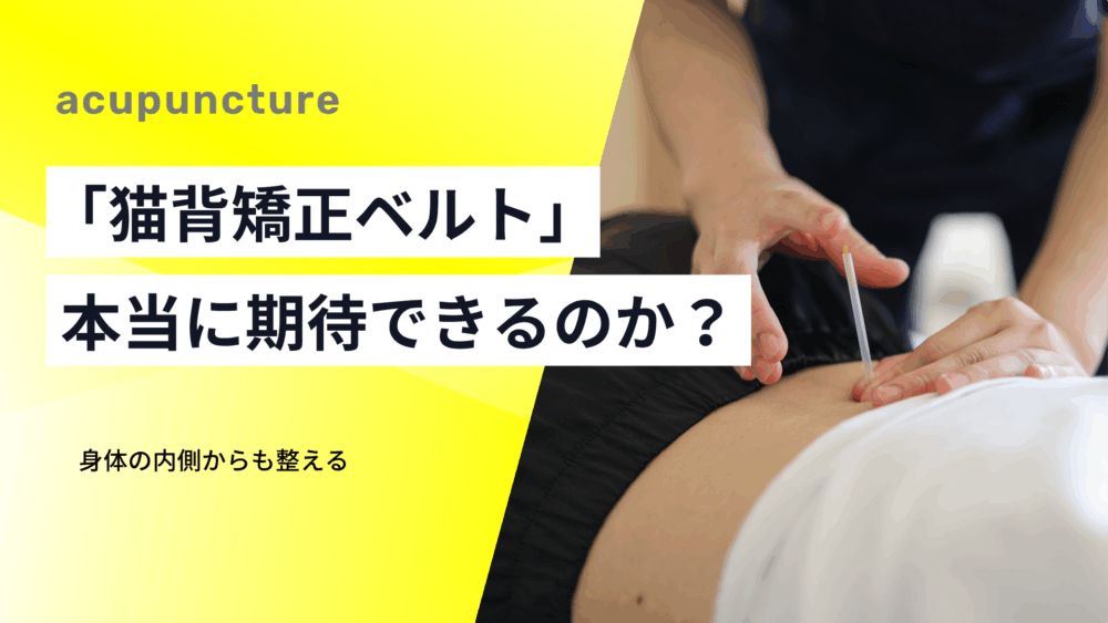 腰痛の対策グッズ「猫背矯正ベルト」は効果は本当に期待できるのか？