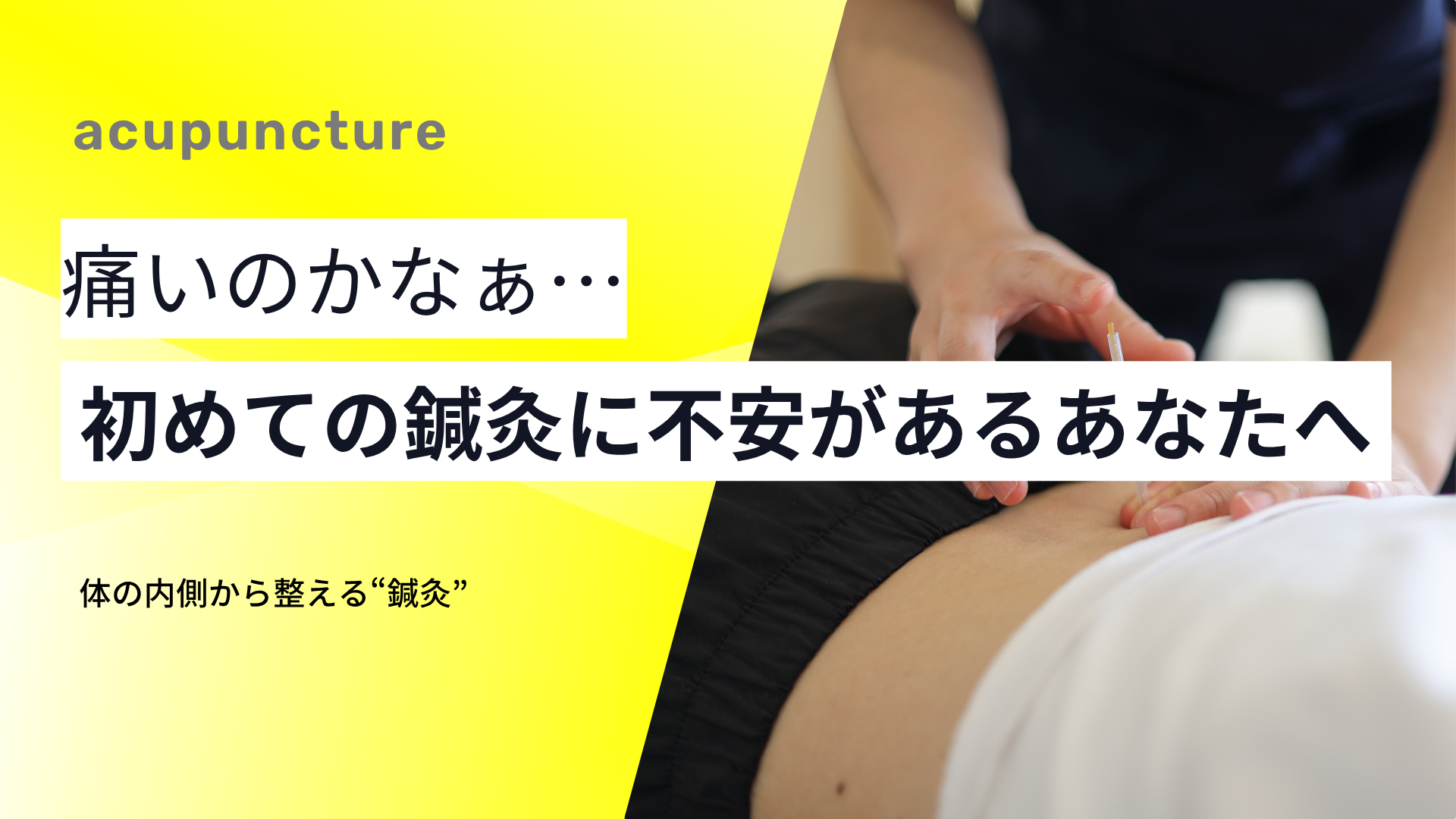 鍼は痛くない！ちょっと不安…そんなあなたへ！